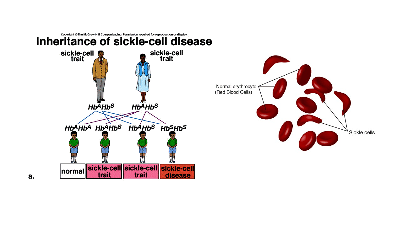 Sickle Cell Disease Awareness Month • Spectrum Health
